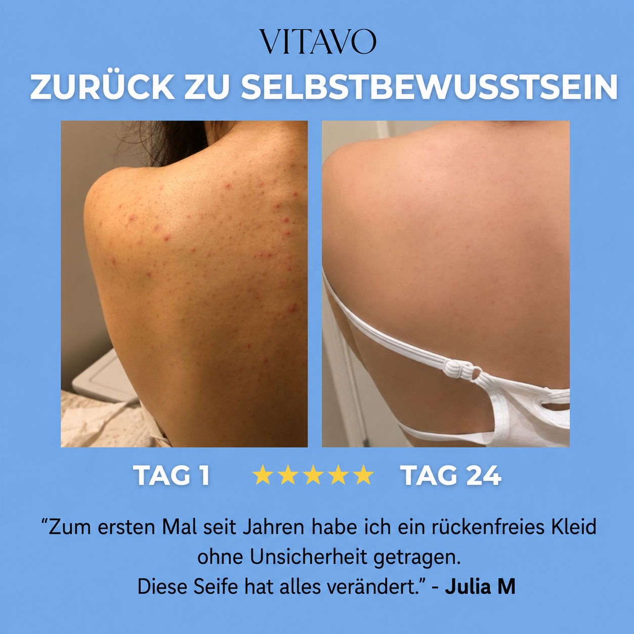 Anti-Akne-Seife
